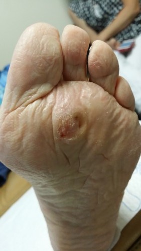 Foot Dermatology