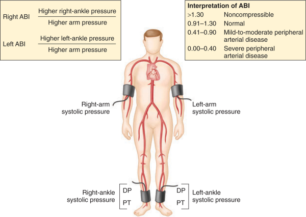 Non-Invasive Vascular Exam