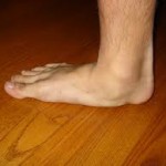 flat foot, pes planus, falling arch, arch, foot pain, heel spur, back pain