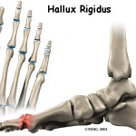 Structural Foot Problems,