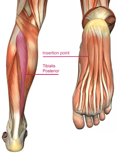Structural Foot Problems, Running Lower Legs