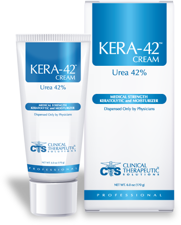 Kera 42 exfoliating Urea cream, Exfoliating Creams, Urea Cream, Callus Remover, Callus Cream, Callus Treatment, Salacylic Acid Cream, Cracked Heels, Heel fissures, Cracked heel treatments, Thick skin, callus treatment, Tyloma Treatment, thick skin, foot pain, IPK, porokeratosis