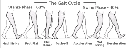 the gait cycle, Foot Types, fitting shoes, fitting shoes high arched feet, edema, high arched feet, orthotics