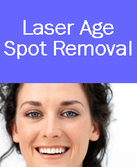 laser age spot removal, laser age spot removal denver, laser age spot removal westminster, laser age spot removal colorado