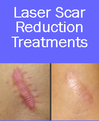 laser scar reduction, scar reduction, laser scar reduction denver, laser scar reduction westminster, laser scar removal
