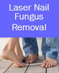 laser nail fungus removal, laser nail fungus removal denver, laser nail fungus westminster, laser nail fungus, laser nail fungus colorodo