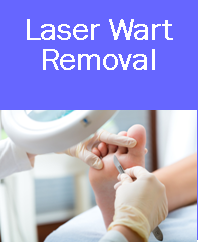 Laser wart removal, laser wart removal denver, laser wart removal westminster, laser wart, wart removal