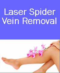 laser spider vein, laser spider vein denver, laser spider vein westminster, laser spider vein, spider vein removal