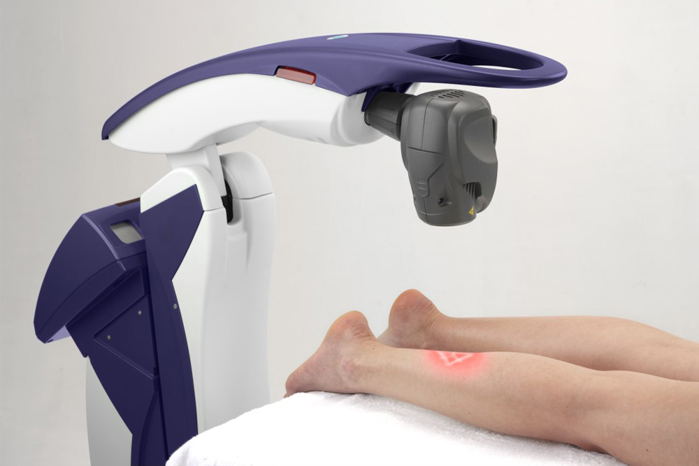Laser neuropathy treatment