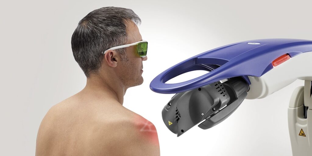 Laser shoulder treatments