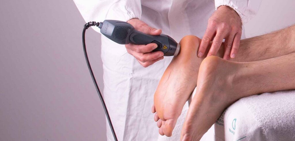 laser plantar fasciitis treatments